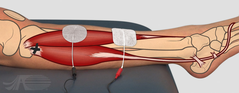 Flexión Plantar Activa y Dorsiflexión