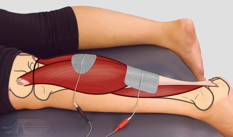 Ankle Plantar Flexion