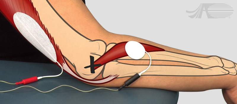 supinator and pronator muscles